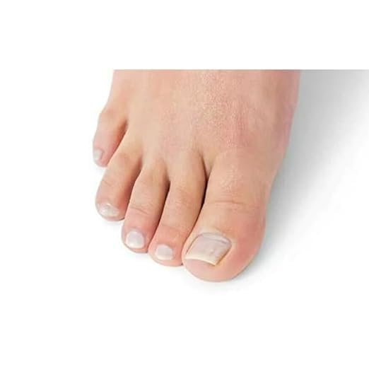 Generic Oriundo Natural Treatment for Nails./ Natural producto para unas., 0.5 Fl Oz (Pack of 1), clear