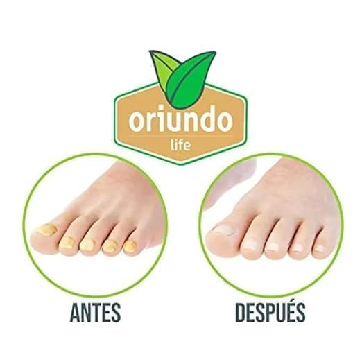 Generic Oriundo Natural Treatment for Nails./ Natural producto para unas., 0.5 Fl Oz (Pack of 1), clear