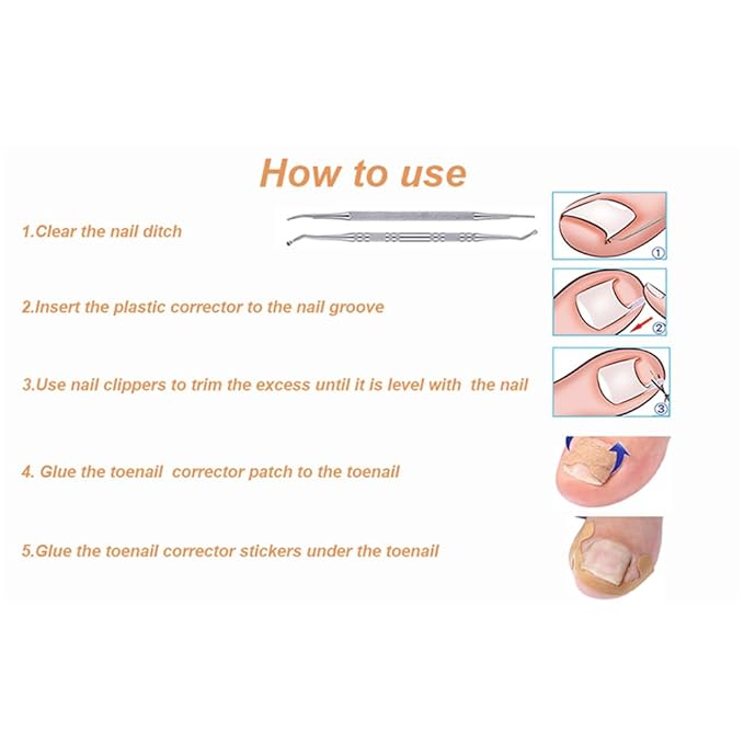 Ingrown toenail treatment, Professional ingrown toenails pedicure tool set, 60Pcs Breathable Toenail Corrector Patch with File and Lifter for Home Pedicure Care
