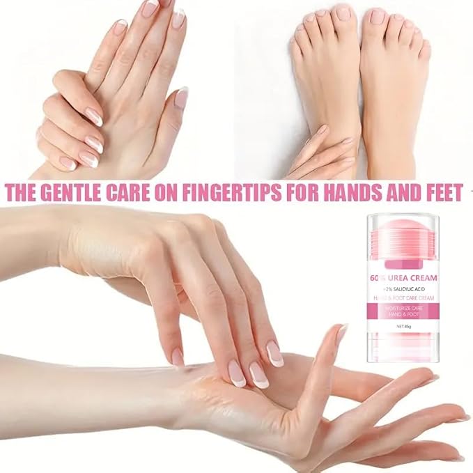 60% Urea plus 2% Salicylic Acid Hand and Foot Cream, Peach Scented Hand and Foot Moisturizer for Rough and Dry Cracked Hands, Elbows, Feet and Heels, Exfoliating Repair Balm, 1.58 OZ