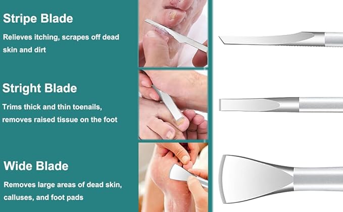 Ingrown Toenail Removal Kit, Pedicure Tools Kit Professional Knife Set Stainless Steel Ingrown Toenail Tool Foot Care Tools Nail Cuticle Remover (5 Pcs Set)