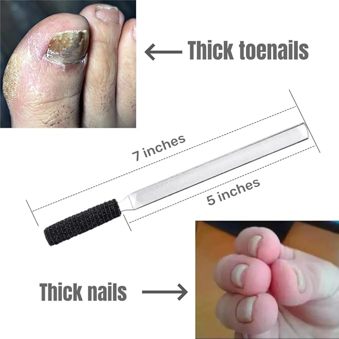 Toe Nail Files for Thick Nails,Stainless Steel 4 Sides 7 inch Length,Nail Files for Men Seniors & Dogs