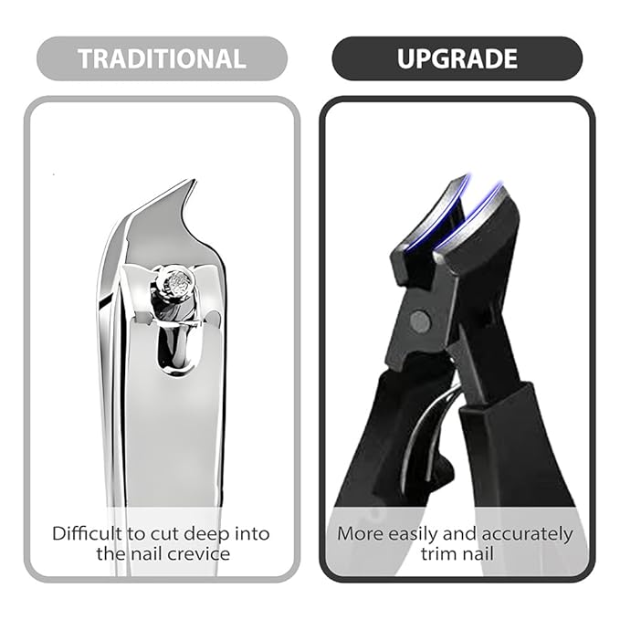 2Pcs Ingrown Toenail Treatment Kit with Wide Jaw Nail Clippers - Heavy Duty Angled Cutters for Thick Toenails & Seniors, Professional Stainless Steel Tools