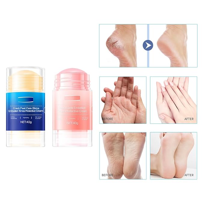 Crack Feet Care Sticks,2 Pack Repair Heel Balm Stick for Dry Cracked Feet,Hand Foot Care Cream Sticks-Moisturizing,Smoothing,Softening,Nourishing and Remove Dead Skin,1.33 Oz