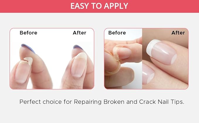 Professional Nail Repair Kit for Broken Cracked Split and Weak Nails. Easy to Use and Apply. Life saver nail Kit for Quick Fix Solution.