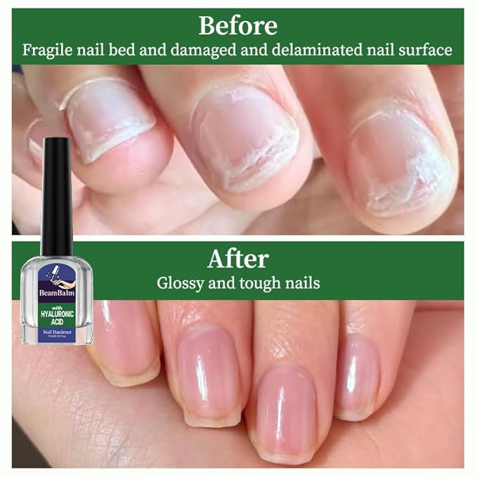 Nail Care - Repairs CrackedCuticles, Fast Absorbing, Suitable forManicures and Home Care Nail Care, CuticleOil, Dry Cuticle Care, Nail Repair SerumHardened Nails (1, 0.37 Fl Oz（pack of 1）)