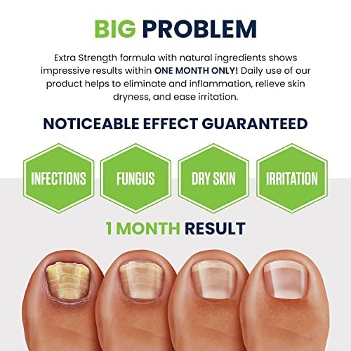 Toenail Fungus Treatment Extra Strength - for fingernails, nail repair, toenail softener, yellow toenail treatment, ingrown nail and foot fungus treatment extra strength