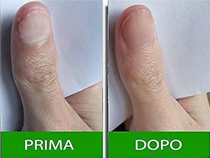 Pantogar (Pantovigar Specific Treatment for Hair and Nails - 90 Cap