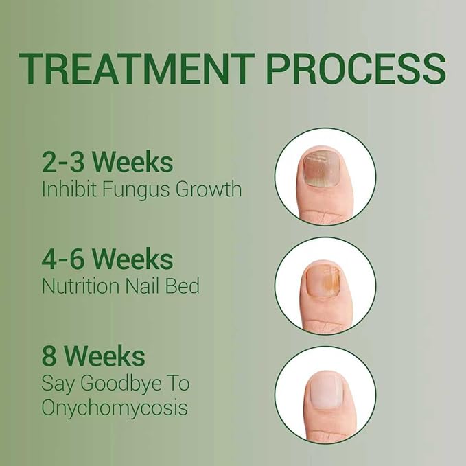 Nail Fungus Treatment Gel - Nail Growth Serum for Repair, Natural Best Repair Solution for Fingernails and Toenails, Multi-Purpose Nail Repair Oil Serum - 2 pcs