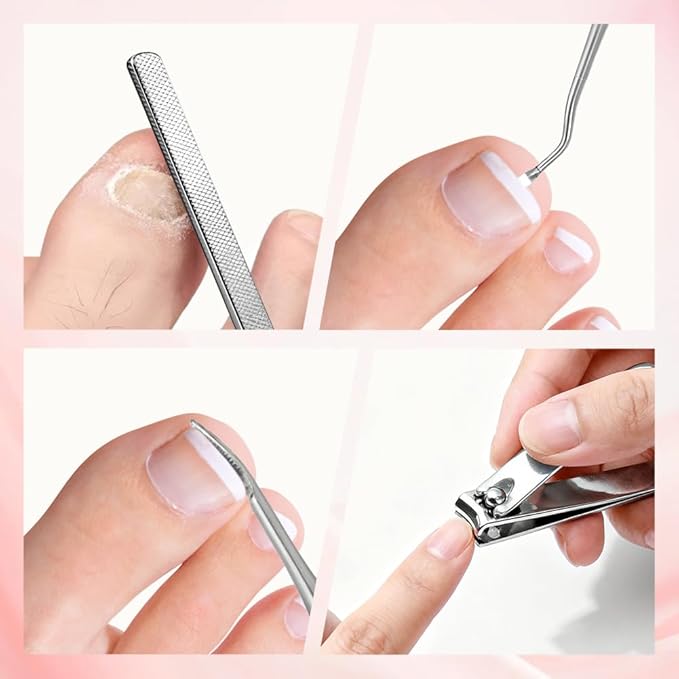 Professional Ingrown Toenail Corrector Set with Correction Strips – Complete Home Pedicure Kit for Men & Women, Non-Slip, Breathable, Pain-Free Relief