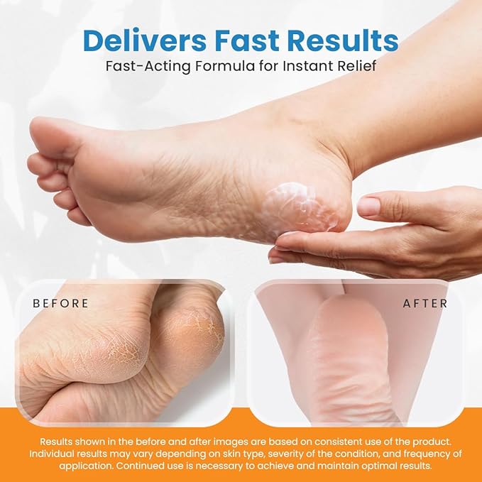 Revitaderm 4D Urea Cream 40% for Feet – Intensive Moisturizing Foot Cream for Dry, Rough & Callused Skin, Fast Absorbing & Fragrance Free, Includes Pumice Stone & Exfoliating Brush, 4 oz, 1 Pack