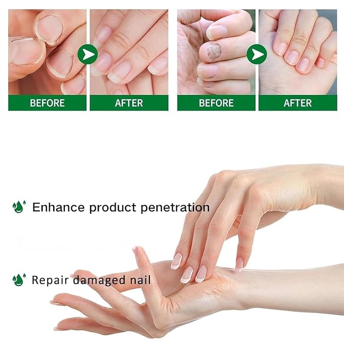 Ginger Nail Growth Strengthener Serum: Ginger-Infused Nail Repair Oil for Care, Natural Nail and Strengthener Solution