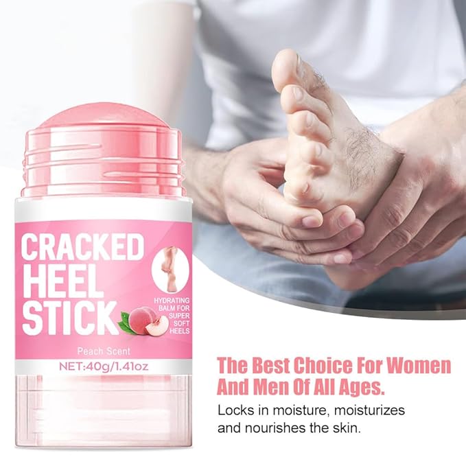 60% Urea Cream plus 2% Salicylic Acid - 1.41 * 2 oz Urea Foot Hand Cream Stick for Removing and Smoothing Cracked Hands Elbows Feet Knees, Moisturizes and Hydrates the Dry Skin, Peach Scent