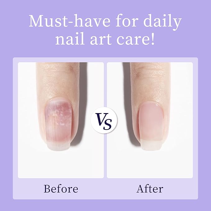 MAYCAHO Nails Cuticle Oil, 15ML Nail & Cuticle Care Strengthener Revitalizing Oil for Nail Growth, 0.5 OZ