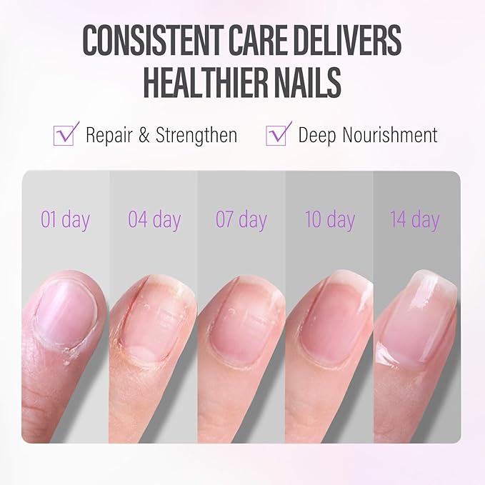 CHUCHU Nail Cuticle Oil Strengthener - Blueberry Scent Repair Growth Moisturizing Treatment - Natural Jojoba Vitamin B & E for Dry Cracked Nails