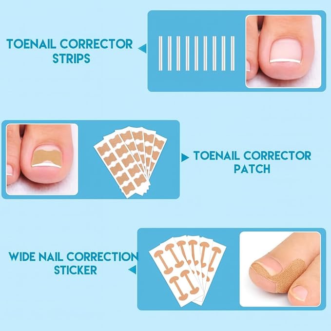 Ingrown Toenail Corrector Set, Professional Toenail Care Set with U-Shaped Breathable Strips, Curved Nail Correction Patch, Painless File & Lifter Tools, At-Home Foot Care for Men & Women.