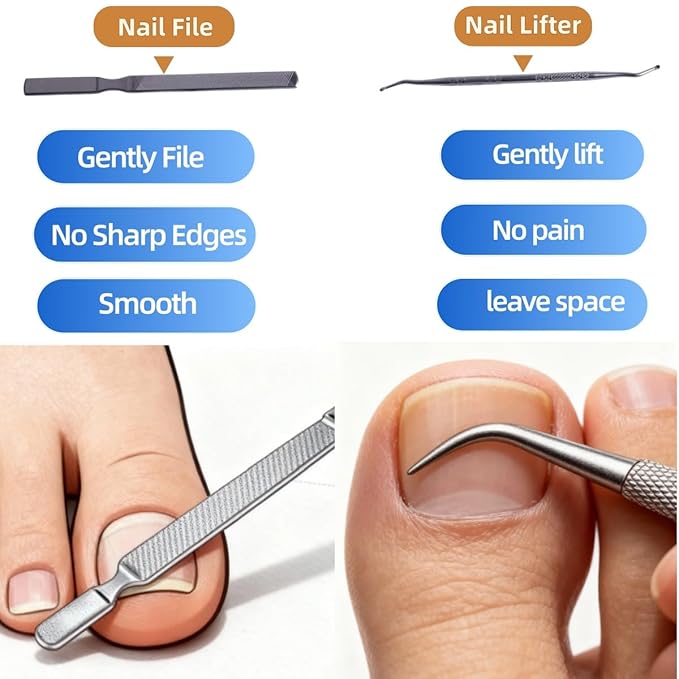 Ingrown Toenail Corrector Set, with Breathable Strips, Painless File & Lifter, Pedicure Tools for Men and Women