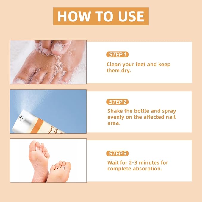 2Pcs Bee Venom Nail Soothing Spray, Advanced Nail Repair Spray, Bee Venom Toe Nail Treatments spray, Nail Care, Gently and Nourishing