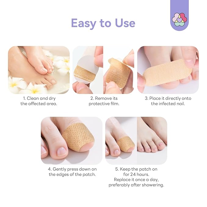 SAVILAND Extra Strength Fungal Nail Patches: 96 Patch 8H Overnight Repair 1% Tolnaftate Toenail Treatment Nighttime Nail Renewal Restores Damaged Nails Discolored Thick Yellow Healthy Appearance