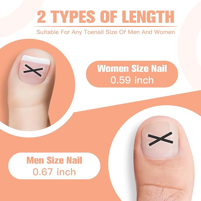 Ingrown Toenail Treatment Kit – Upgraded X-Type Titanium Alloy Corrector for Big Toe Relief, At Home Ingrown Toenail Removal Tool with Clippers and Braces