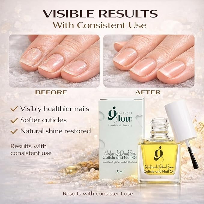 Dead Sea Cuticle & Nail Oil 5ML | Strengthens & Moisturizes Dry & Cracked Cuticles | With Almond, Olive, Argan, Jojoba & Castor Oils, Vitamin E | Nail Repair & Conditioning Oil