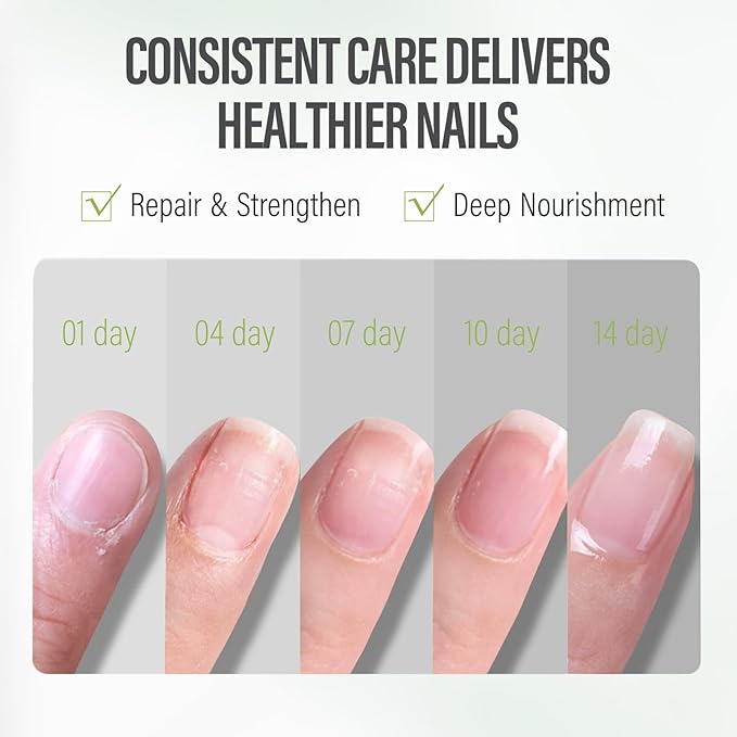CHUCHU Nail Cuticle Oil Strengthener - Kiwi Scent Repair Growth Moisturizing Treatment - Natural Jojoba Vitamin B & E for Dry Cracked Nails