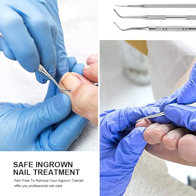 Teenitor Pedicure Tools for Feet, Toenail File and Lifters, Ingrown Toenail Removal Kit Pain Relief (Silver)