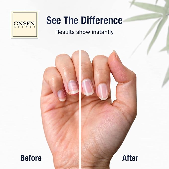 Onsen Secret Japanese Nail Reboot Cuticle Oil Kit | Buffer and Shine Kit w/ Professional File, 3-Way Buffer Block & Free Replacement Pads | Strengthening Combo for Healthy Nails, 1pk