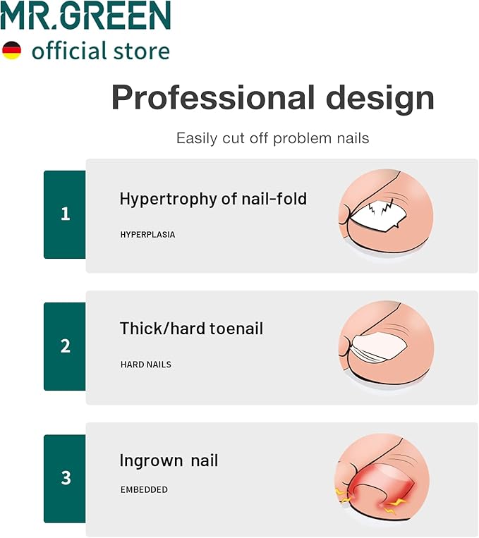 MR.GREEN Toenail Clippers Stainless Steel Ingrown Nail Cutter Thick and Hard Nails Pedicure Manicure Tools (Green)