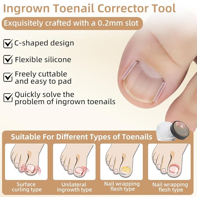 Ingrown Toenail Corrector Set with Breathable Correction Strips, Upgraded Ingrown Toenail Treatment Kit, Curved Toenails Corrector Patch, Pedicure Tools, for Home Use Women Man