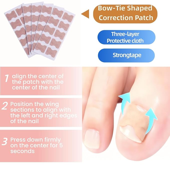 Ingrown Toenail Corrector Set, with Breathable Strips, Painless File & Lifter, Pedicure Tools for Men and Women