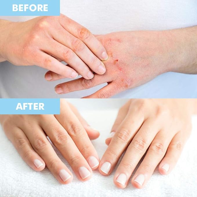 Bodipure Premium Hand and Foot Mask | Moisturizing Kertain Gloves & Socks | Hydrating Dull Dry Hands, Cracked Heels, Callus Softening & Nail Strengthening | Chemical-Free Feet Treatment | (3+3 Pack)