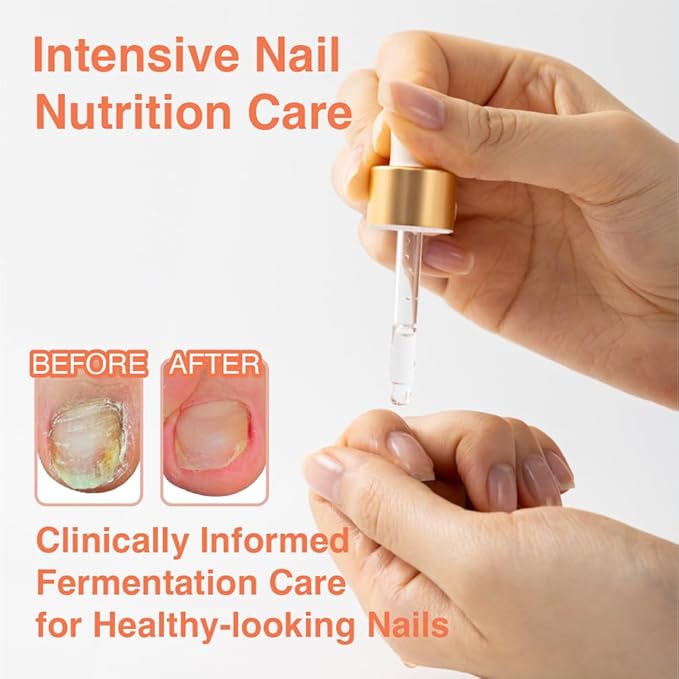Fermentation Ampoule | Vegan Nail & Cuticle Serum | Moisturizing Nail Treatment | Herbal Fermented Ingredients | Intensive Repair Care | Natural Nail Strengthener | Korean Beauty | 15ml