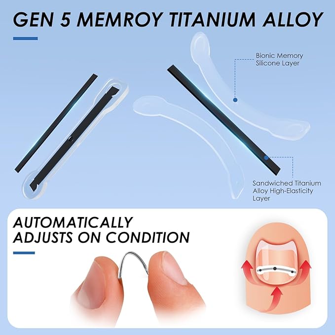 Titanium Ingrown Toenail Treatment,Ingrown Toenail Corrector for All Size Curve Correct, Nail Wraps & Nail Repair Products