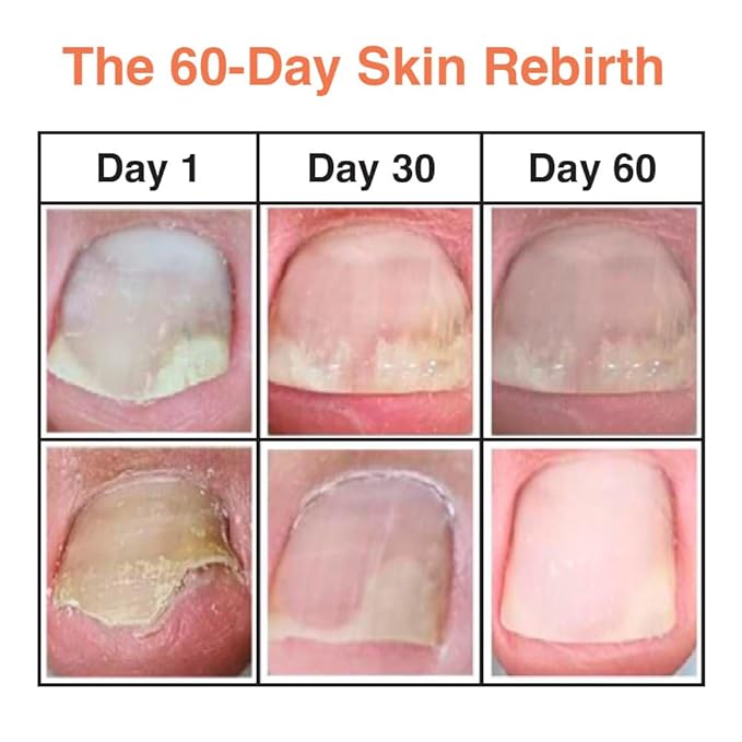 Fermentation Ampoule Pad | Nail & Cuticle Treatment Wipes | Vegan Hydrating Nail Care | Fermented Herbal Extracts | Easy Daily Nail Repair | Korean Beauty On-the-Go | 10Pcs