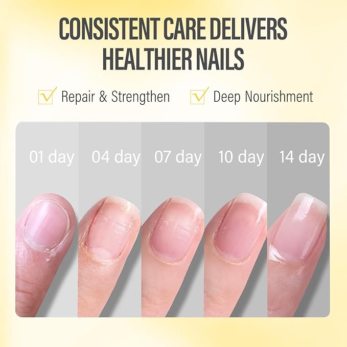 CHUCHU Nail Cuticle Oil Strengthener - Pineapple Scent Repair Growth Moisturizing Treatment - Natural Jojoba Vitamin B & E for Dry Cracked Nails