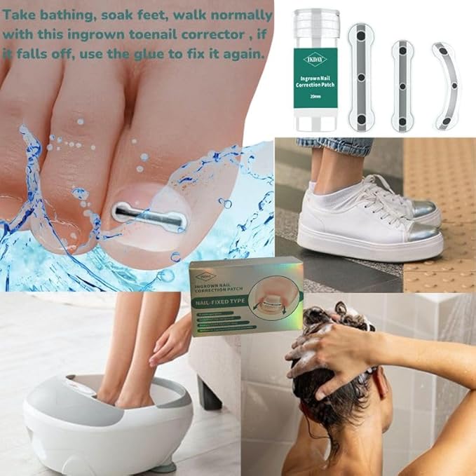 Ingrown Toenail Removal Kit | Titanium Alloy Ingrown Toenail Treatment | Pedicure Tools for Feet, Nail Tools Specially Designed for Curved Nail Repair and Ingrown Toenail Corrector (0.67/0.79in)