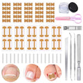 Ingrown Toenail Corrector Kit with Correction Strips, Breathable Ingrown Toenail Tape, Removal Kit for Ingrown Toenails in Women And Men