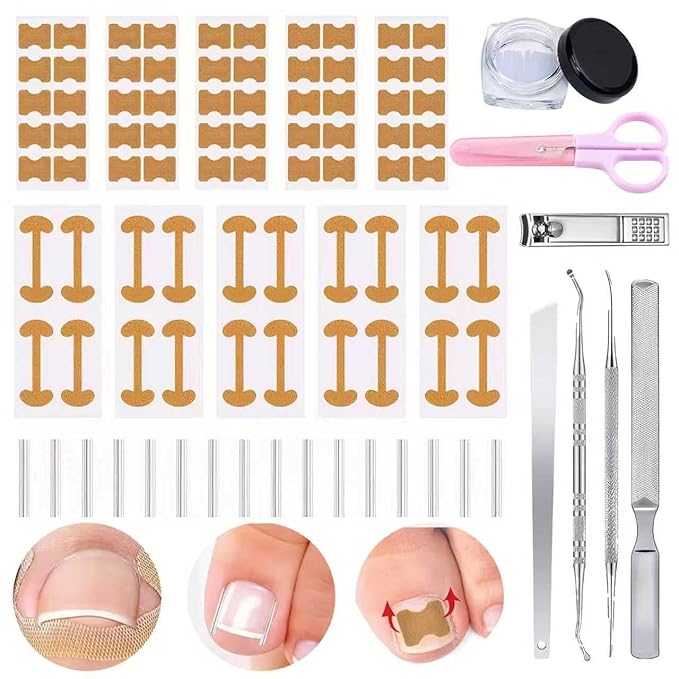 Ingrown Toenail Corrector Kit with Correction Strips, Breathable Ingrown Toenail Tape, Removal Kit for Ingrown Toenails in Women And Men
