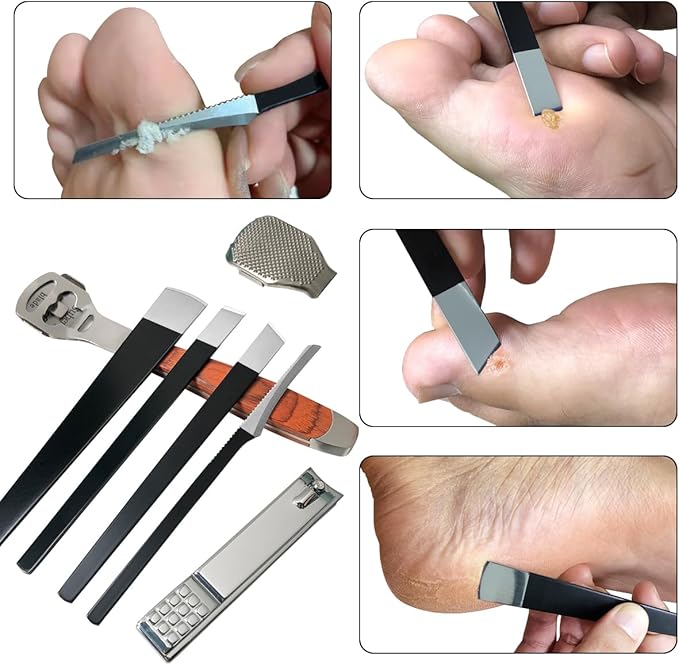 37 Pcs Callus Shaver for Feet Set (1 Foot Razor for Callus Removal & 4 Pedicure Knife & 1 File Heads & 1 Nail Clippers & 30 Replacement Slices Blades) Foot Callus Shaver