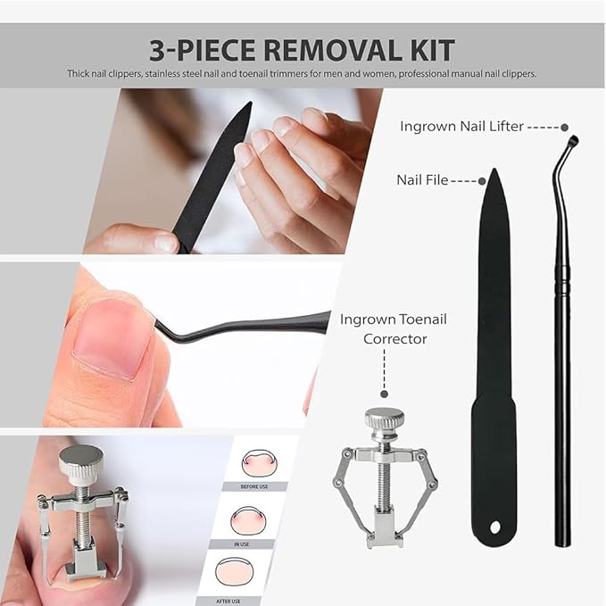 6Pcs Ingrown Toenail Removal Kit, Pedicure Tools for Feet with Fingernail & Toenail Clippers, Professional Nail Cutter Set for Thick Nails, Manicure & Nail Care Tools for Men & Women