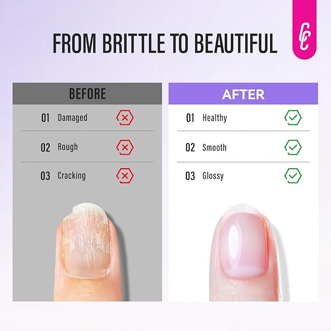 CHUCHU Nail Repair and Cuticle Remover Set: 2pcs 15ml Clear Nail Strengthening Polish for Peeling Thin Nails Women Home Salon Routine