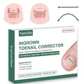 Dual Nitinol Ingrown Toenail Corrector,Ingrown Toenail Treatment,Curved Toenail Straightener,Ingrown Toenail Removal Kit,Big Toe Ingrown Toenail Tool (0.55in,0.66in)