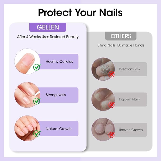 Gellen Nail Biting Prevention for Kids & Adults, Roll-On Nail Biting Treatment, Bitter Taste Thumb Sucking Deterrent, Quick-Dry No Bite Nail Polish, Nail Care to Help Stop Finger Biting & Nail Repair