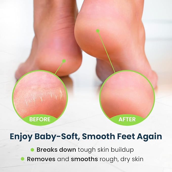 Toenail Fungus Treatment Extra Strength - for fingernails, nail repair, toenail softener, yellow toenail treatment, ingrown nail and foot fungus treatment extra strength