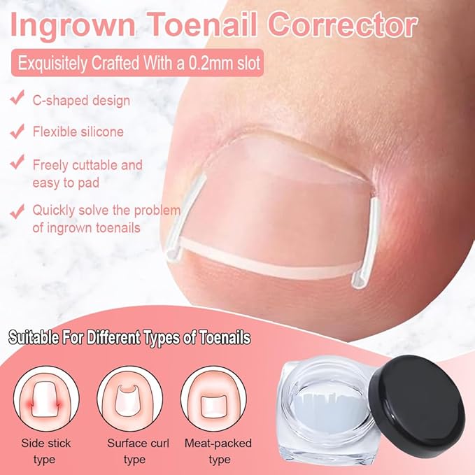Ingrown Toenail Removal Kit,Professional Toenail Tool Kit Includes Breathable Toenail Strips, Curved Toenails Corrector Patch, Painless File and Lifter Pedicure Tools, Professional Pedicure Tool