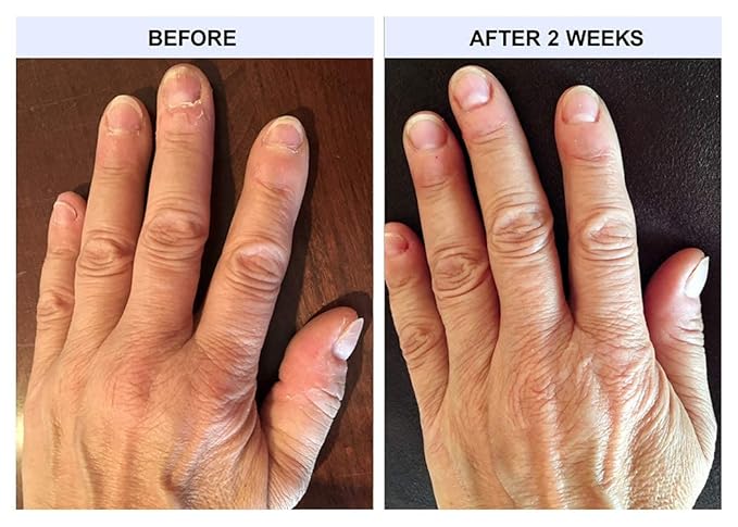 TIPS Nail Conditioner 3 Pack