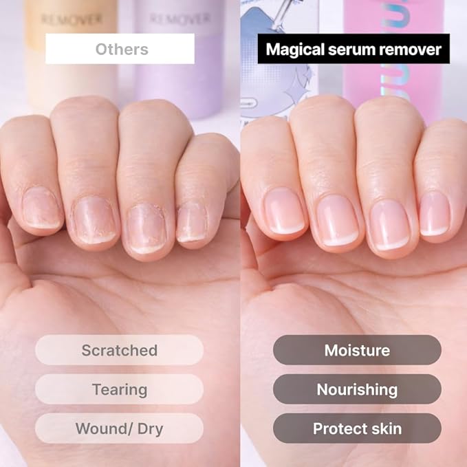 UUUUU Gel Nail Strip and Press Ons Remover | Magical Nail Serum Remover for Semi-Cured Gel Strips | Gel Remover for Nails | Non-Toxic, Odorless, Gentle & Nourishing Formula | Vegan & Cuticle-Safe