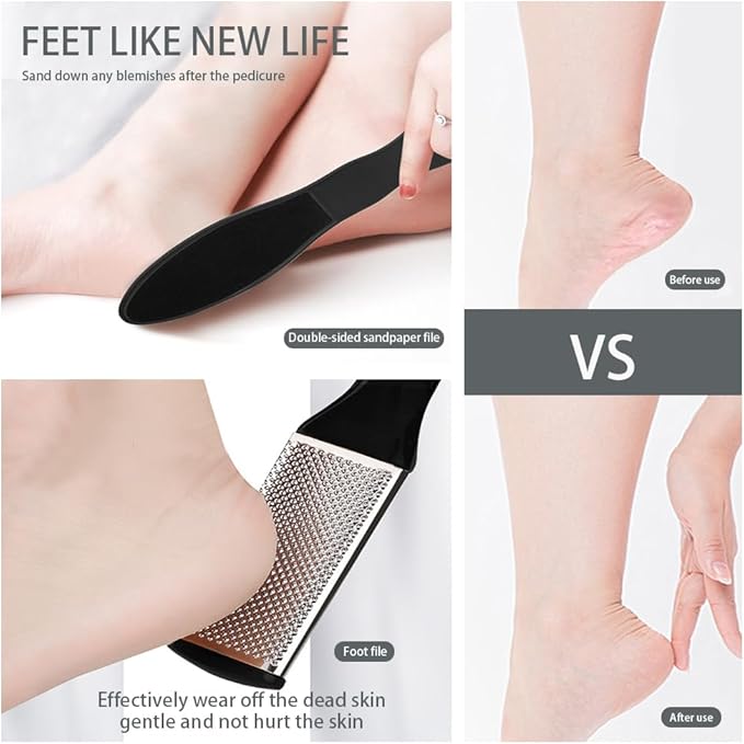 Professional Pedicure Tools Set, 10 in 1 Stainless Steel Pedicure Foot Supplies Set, Foot Files Kit, Callus Remover, Pedicure Tools for Feet Spa