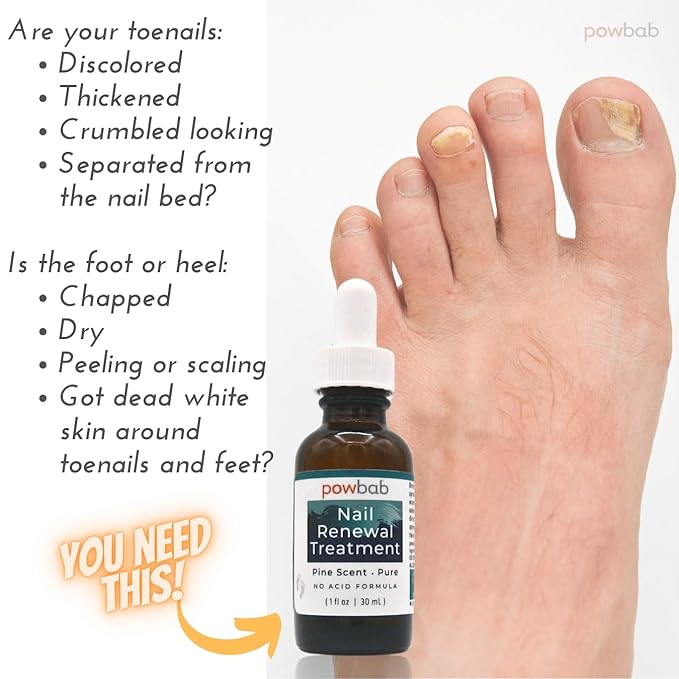 powbab Nail Renewal Treatment for Toenail. Pine Needle Scent, No Acid Formula. 100% Natural Solution Toenail Treatment Extra Strength for Foot and Nail. Natural Toe Nail Treatment - 1 oz